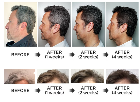 HairRevive™ | סרום שיער נגד אפור