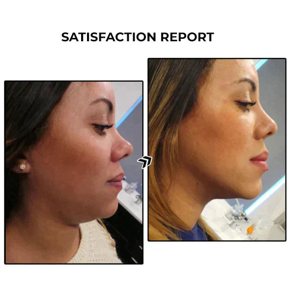 PetalTrim™ | עגילי גרמניום לירידה במשקל