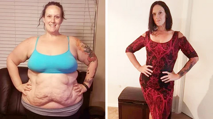 SlimRevive™ | חזיית Ion Lifting & Lymphvity