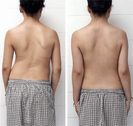 SlimRevive™ | חזיית Ion Lifting & Lymphvity