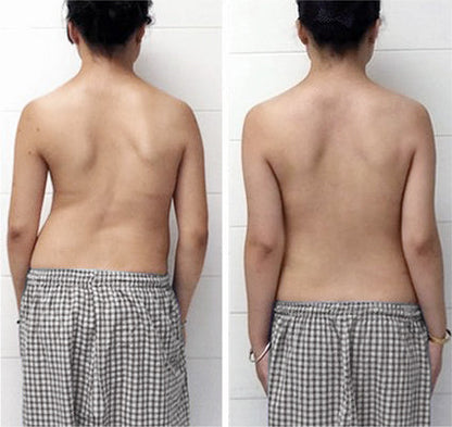 SlimRevive™ | חזיית Ion Lifting & Lymphvity