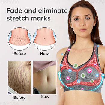 SlimRevive™ | חזיית Ion Lifting & Lymphvity