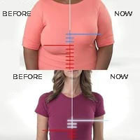 ShapeSaver™ | חזיית Lift Up נוחה (1+1 בחינם)